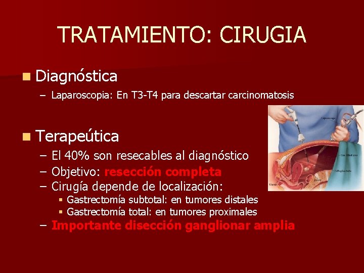 TRATAMIENTO: CIRUGIA n Diagnóstica – Laparoscopia: En T 3 -T 4 para descartar carcinomatosis