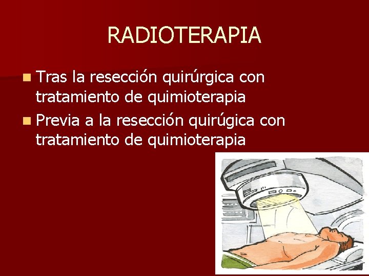 RADIOTERAPIA n Tras la resección quirúrgica con tratamiento de quimioterapia n Previa a la