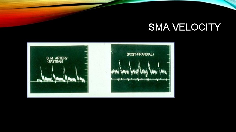 SMA VELOCITY 