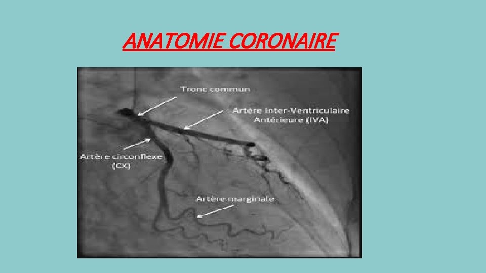 ANATOMIE CORONAIRE 