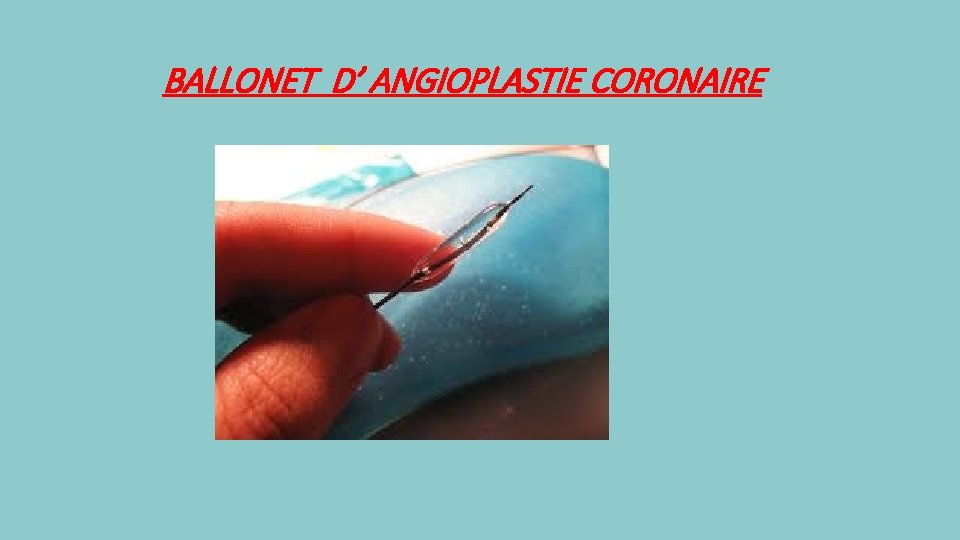 BALLONET D’ ANGIOPLASTIE CORONAIRE 