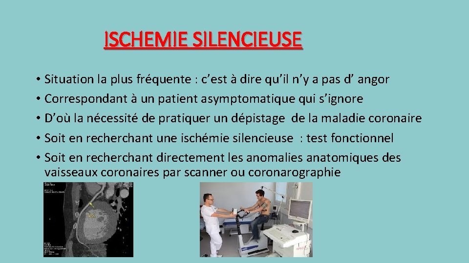 ISCHEMIE SILENCIEUSE • Situation la plus fréquente : c’est à dire qu’il n’y a