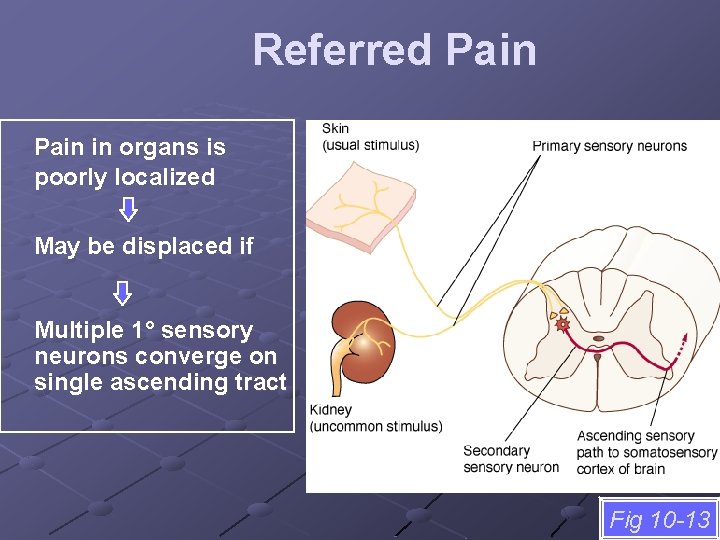 Referred Pain in organs is poorly localized May be displaced if Multiple 1° sensory