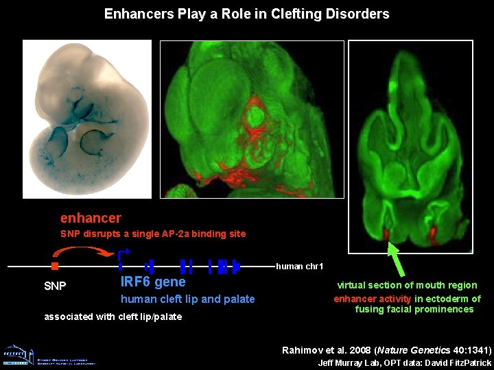 Enhancers Play a Role in Clefting Disorders enhancer SNP disrupts a single AP-2 a Enhancers Play a Role in Clefting Disorders enhancer SNP disrupts a single AP-2 a