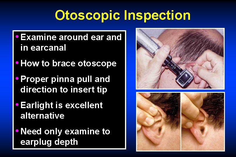 Otoscopic Inspection • Examine around ear and in earcanal • How to brace otoscope
