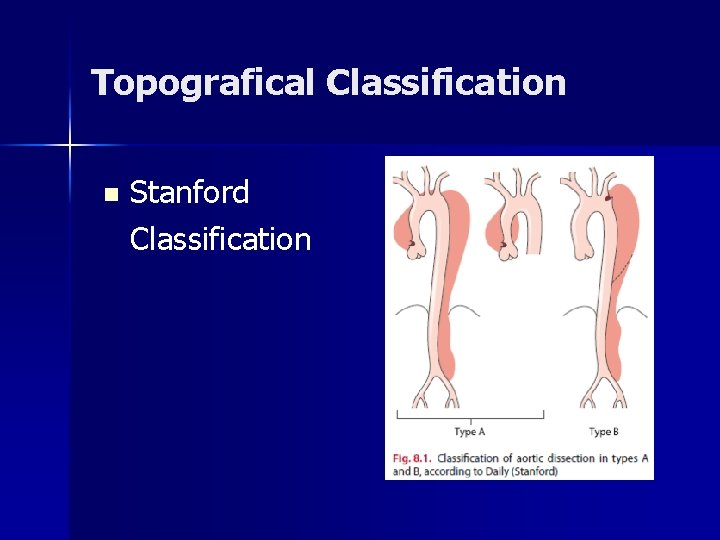 Topografical Classification n Stanford Classification Topografical Classification n Stanford Classification