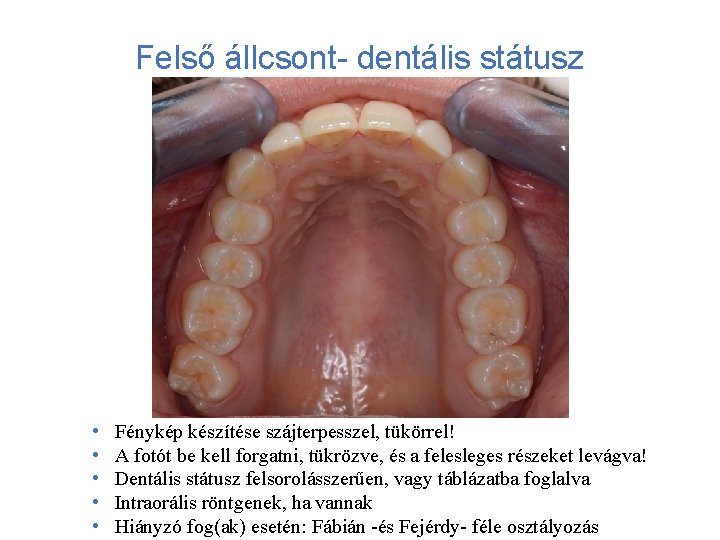 Felső állcsont- dentális státusz • • • Fénykép készítése szájterpesszel, tükörrel! A fotót be