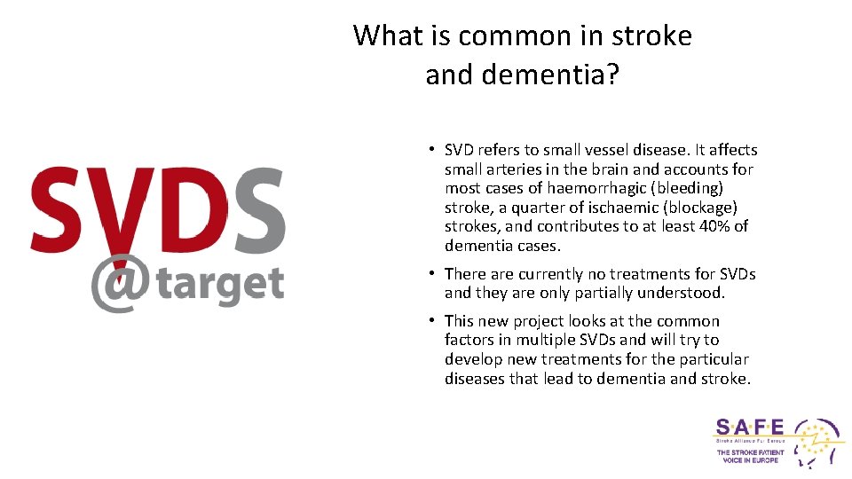 What is common in stroke and dementia? • SVD refers to small vessel disease.