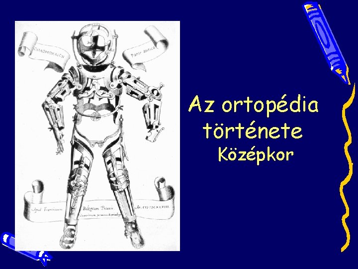 Az ortopédia története Középkor Az ortopédia története Középkor