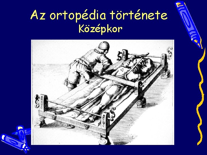 Az ortopédia története Középkor Az ortopédia története Középkor