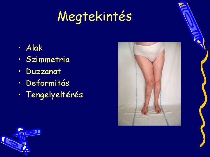 Megtekintés • • • Alak Szimmetria Duzzanat Deformitás Tengelyeltérés Megtekintés • • • Alak Szimmetria Duzzanat Deformitás Tengelyeltérés