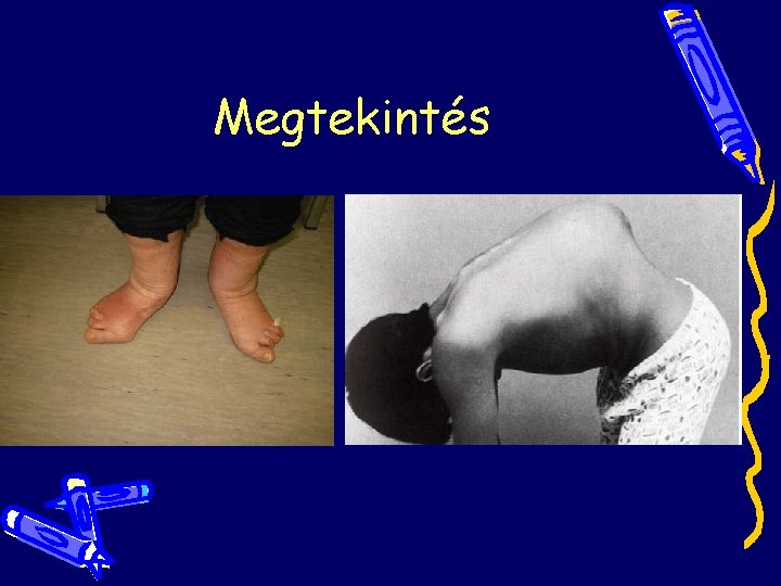 Megtekintés Megtekintés