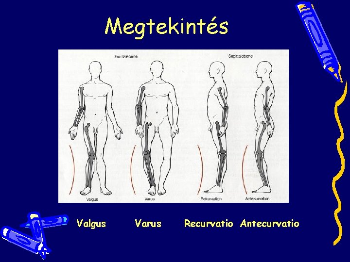 Megtekintés Valgus Varus Recurvatio Antecurvatio Megtekintés Valgus Varus Recurvatio Antecurvatio