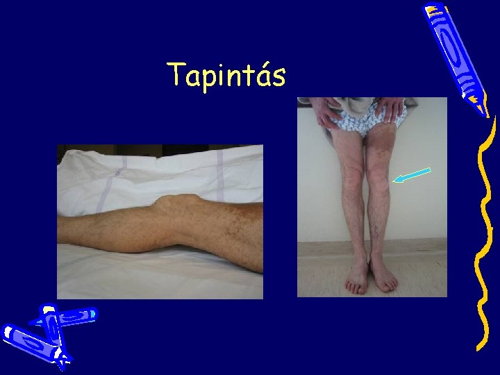 Tapintás Tapintás