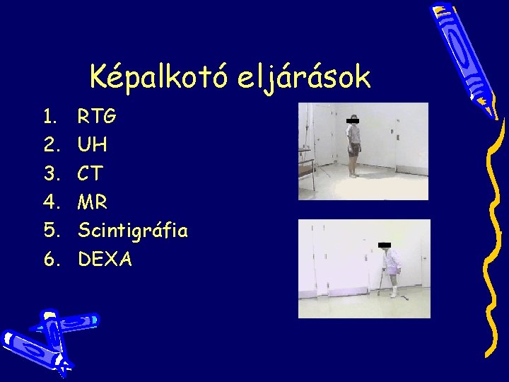 Képalkotó eljárások 1. 2. 3. 4. 5. 6. RTG UH CT MR Scintigráfia DEXA Képalkotó eljárások 1. 2. 3. 4. 5. 6. RTG UH CT MR Scintigráfia DEXA