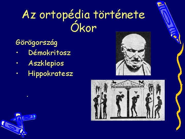 Az ortopédia története Ókor Görögország • Démokritosz • Aszklepios • Hippokratesz. Az ortopédia története Ókor Görögország • Démokritosz • Aszklepios • Hippokratesz.
