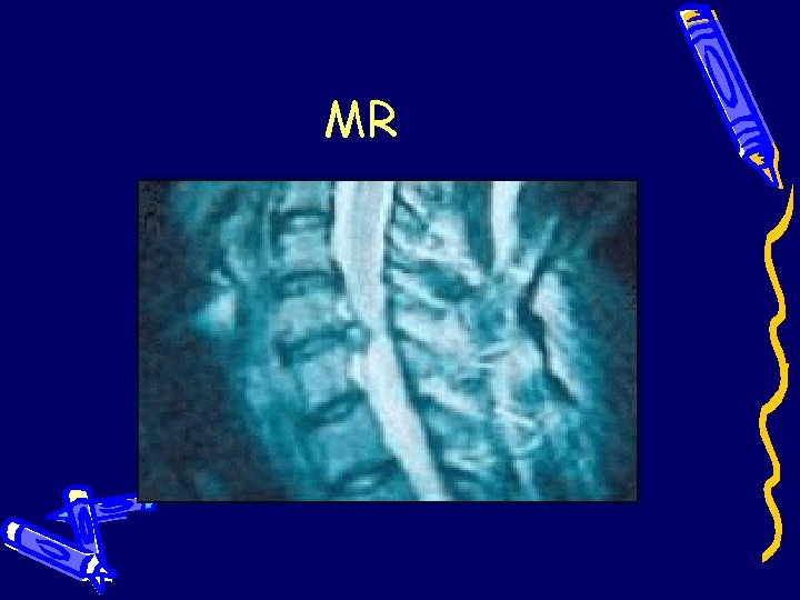 MR MR