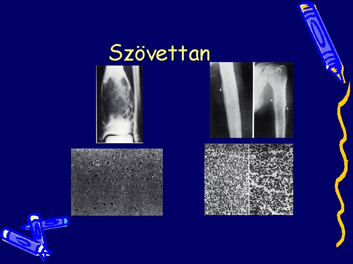 Szövettan Szövettan