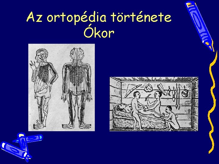 Az ortopédia története Ókor Az ortopédia története Ókor