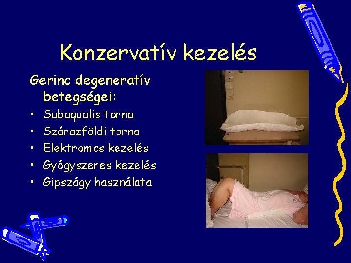Konzervatív kezelés Gerinc degeneratív betegségei: • • • Subaqualis torna Szárazföldi torna Elektromos kezelés Konzervatív kezelés Gerinc degeneratív betegségei: • • • Subaqualis torna Szárazföldi torna Elektromos kezelés