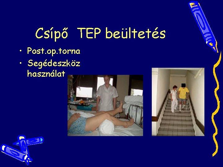 Csípő TEP beültetés • Post. op. torna • Segédeszköz használat Csípő TEP beültetés • Post. op. torna • Segédeszköz használat