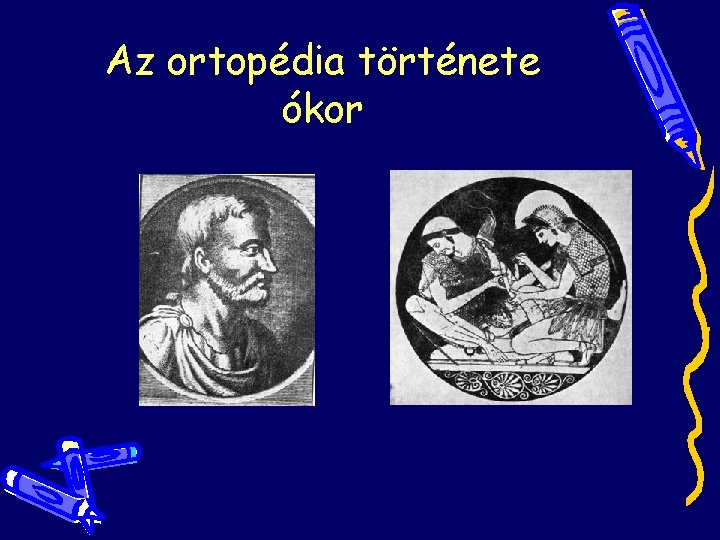 Az ortopédia története ókor Az ortopédia története ókor