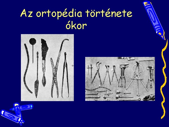 Az ortopédia története ókor Az ortopédia története ókor