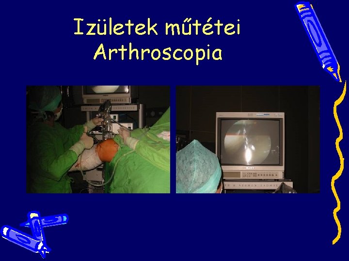 Izületek műtétei Arthroscopia Izületek műtétei Arthroscopia