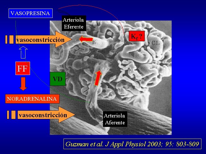 VASOPRESINA Arteriola Eferente Kf ? vasoconstricción FF VD NORADRENALINA vasoconstricción Arteriola Aferente Guzman et