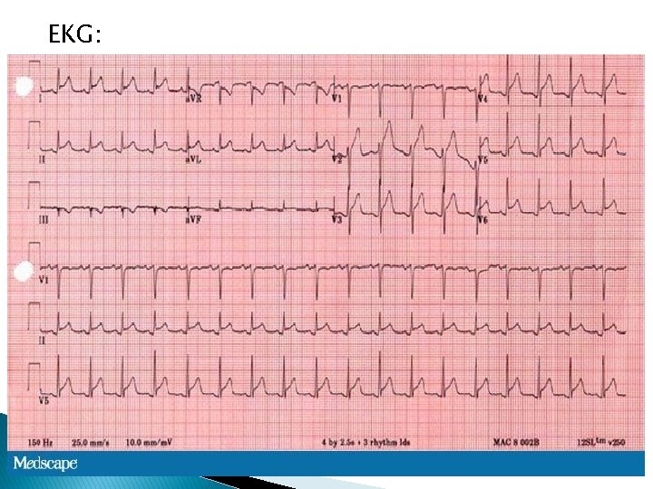 EKG: 8 