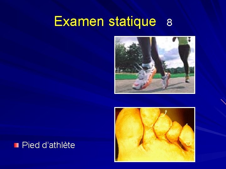 Examen statique Pied d’athlète 8 