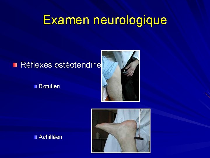 Examen neurologique Réflexes ostéotendineux Rotulien Achilléen 