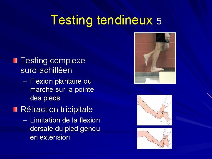 Testing tendineux 5 Testing complexe suro-achilléen – Flexion plantaire ou marche sur la pointe