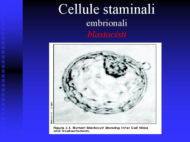 Cellule staminali embrionali blastocisti 