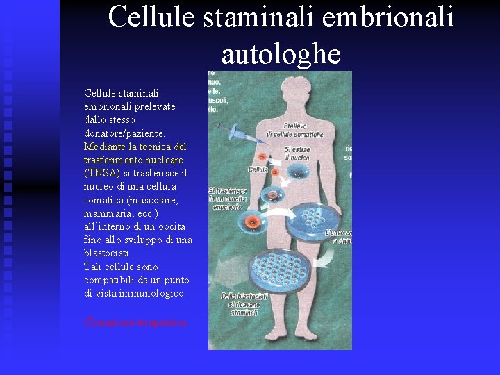 Cellule staminali embrionali autologhe Cellule staminali embrionali prelevate dallo stesso donatore/paziente. Mediante la tecnica