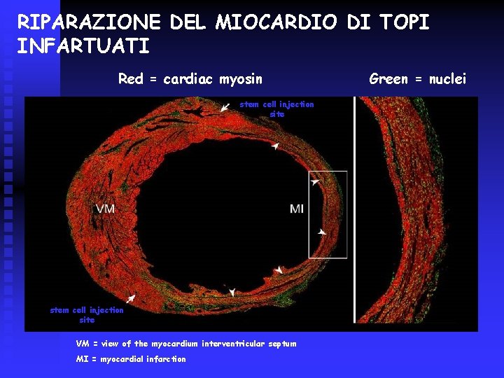 RIPARAZIONE DEL MIOCARDIO DI TOPI INFARTUATI Red = cardiac myosin stem cell injection site