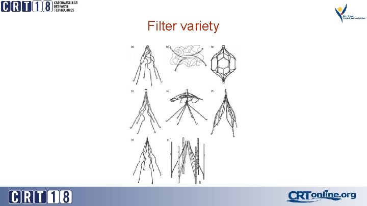 Filter variety 