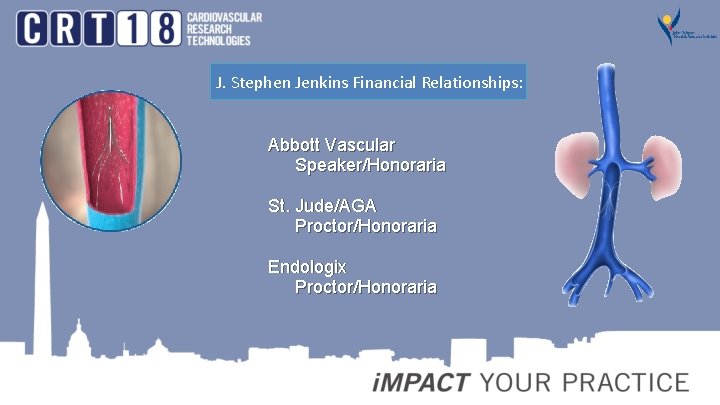 J. Stephen Jenkins Financial Relationships: Abbott Vascular Speaker/Honoraria St. Jude/AGA Proctor/Honoraria Endologix Proctor/Honoraria 