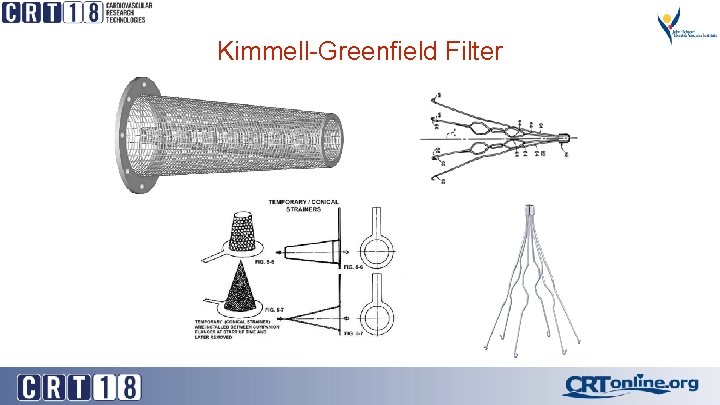 Kimmell-Greenfield Filter 