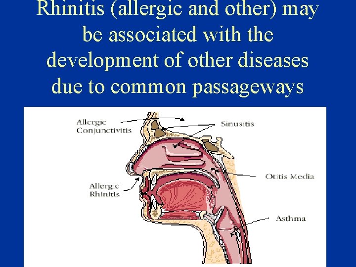 Rhinitis (allergic and other) may be associated with the development of other diseases due