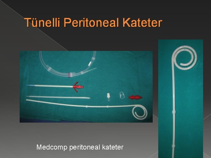 Tünelli Peritoneal Kateter Medcomp peritoneal kateter 