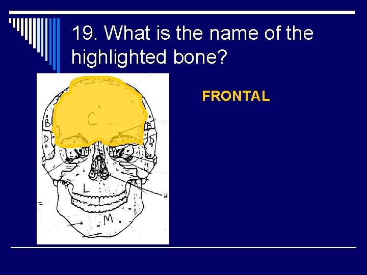 19. What is the name of the highlighted bone? FRONTAL 