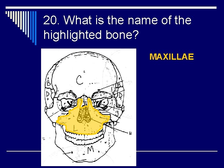 20. What is the name of the highlighted bone? MAXILLAE 