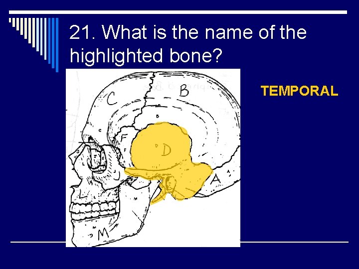 21. What is the name of the highlighted bone? TEMPORAL 