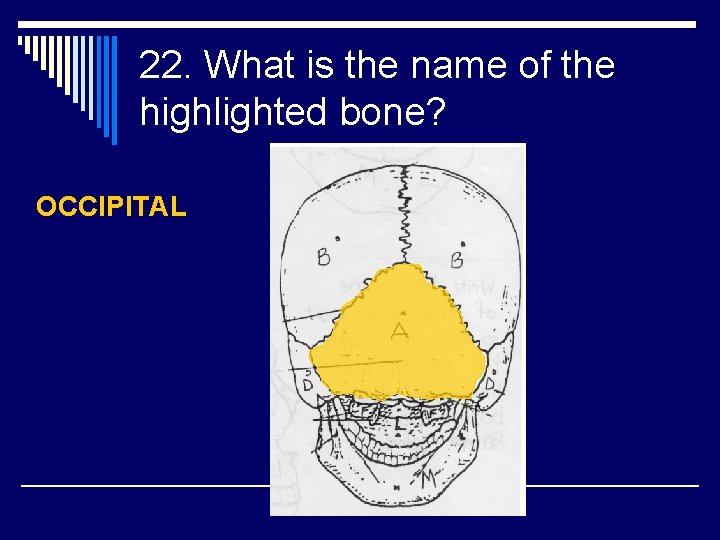 22. What is the name of the highlighted bone? OCCIPITAL 