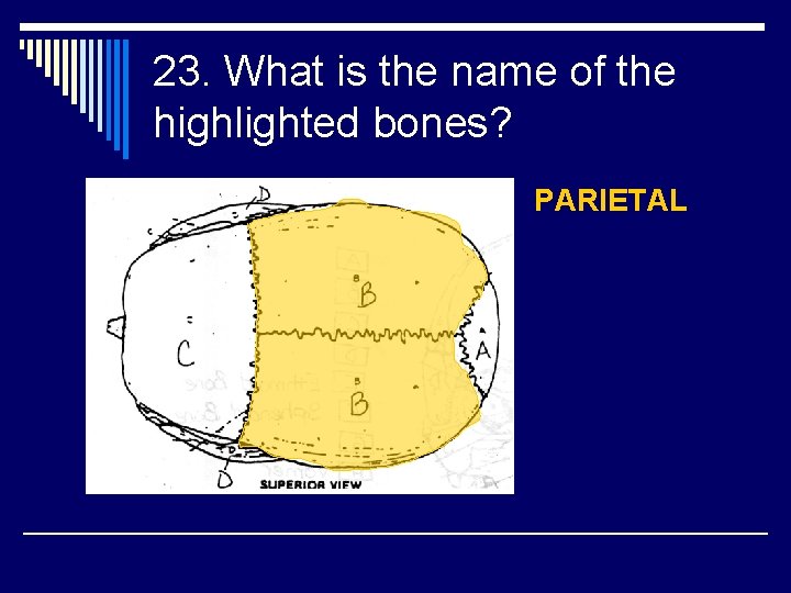23. What is the name of the highlighted bones? PARIETAL 