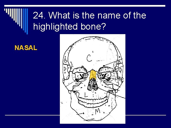 24. What is the name of the highlighted bone? NASAL 