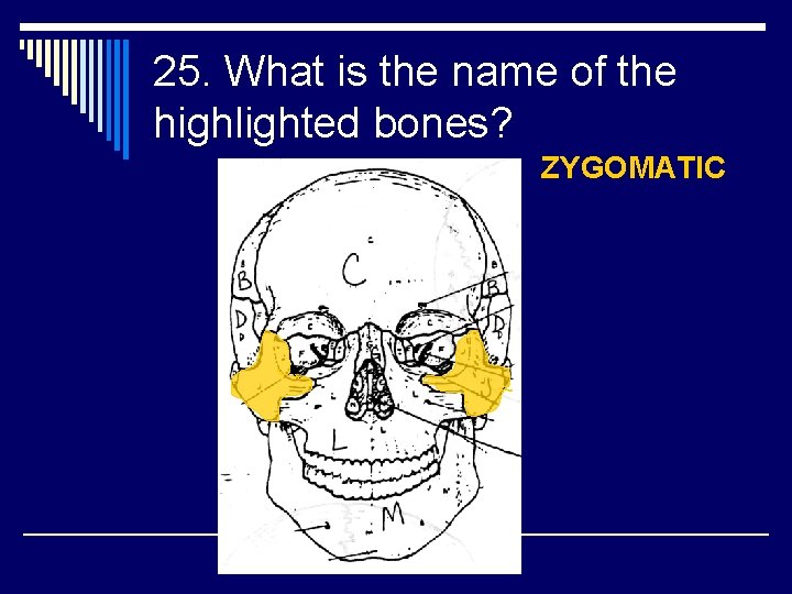 25. What is the name of the highlighted bones? ZYGOMATIC 