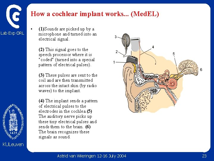 How a cochlear implant works. . . (Med. EL) Lab Exp ORL • (1)Sounds How a cochlear implant works. . . (Med. EL) Lab Exp ORL • (1)Sounds