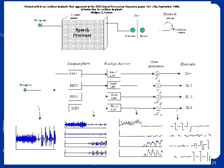 Tutorial article on cochlear implants that appeared in the IEEE Signal Processing Magazine, pages Tutorial article on cochlear implants that appeared in the IEEE Signal Processing Magazine, pages